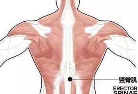锻炼竖脊肌的好处,有预防脊柱退变等作用