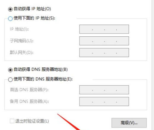 电脑IP怎么设置自动获取？电脑IP设置自动获取步骤